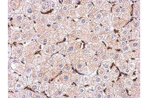 Immunohistochemistry (IHC) image for anti-Ionized Calcium-binding Adapter Molecule 1 (IBA1) (C-Term) antibody (ABIN2857032)