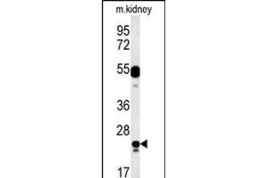 LYSMD1 Antibody (C-term) (ABIN651931 and ABIN2840459) western blot analysis in mouse kidney tissue lysates (15 μg/lane). (LYSMD1 Antikörper  (C-Term))