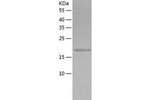 Western Blotting (WB) image for 5,10-Methenyltetrahydrofolate Synthetase (5-Formyltetrahydrofolate Cyclo-Ligase) (MTHFS) (AA 1-203) protein (His tag) (ABIN7121621)