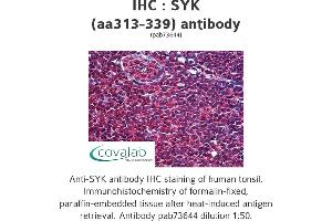Image no. 1 for anti-Spleen tyrosine Kinase (SYK) (AA 313-339) antibody (ABIN1739810) (SYK Antikörper  (AA 313-339))
