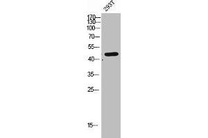 Western Blot analysis of 293T cells using CLN5 Polyclonal Antibody (CLN5 Antikörper  (Internal Region))