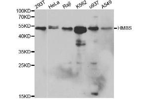 Western blot analysis of extracts of various cell lines, using HMBS antibody. (HMBS Antikörper  (AA 1-361))