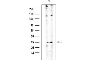 Western blot analysis of lysates from EC304 cells, using TUSC1 Mouse Monoclonal Antibody at 1/1000 dilution.