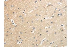 The image on the left is immunohistochemistry of paraffin-embedded Human brain tissue using ABIN7192521(SLC7A11 Antibody) at dilution 1/35, on the right is treated with synthetic peptide. (SLC7A11 Antikörper)