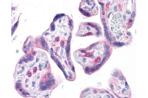 LRRC59 antibody was used for immunohistochemistry at a concentration of 4-8 ug/ml. (LRRC59 Antikörper  (N-Term))