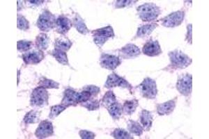Anti-GPR17 antibody immunocytochemistry (ICC) staining of untransfected HEK293 human embryonic kidney cells. (GPR17 Antikörper  (N-Term))