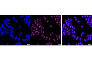 Immunocytochemical staining of HeLa cells with MOV10 antibody (ABIN7799485), 1:1,000). (Rekombinanter Mov10 RISC Complex RNA Helicase (MOV10) Antikörper)