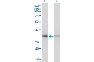 Western Blot analysis of ANXA4 expression in transfected 293T cell line by ANXA4 monoclonal antibody (M13), clone 1D3.