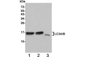 Western blot testing of 1) rat cerebral cortex, 2) rat brain and 3) human HeLa cell  lysates using LC3A/B antibody at 1:1000. (LC3A / LC3B Antikörper)