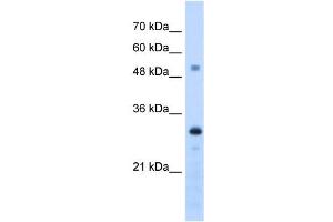 PSME3 antibody used at 1. (PSME3 Antikörper  (C-Term))