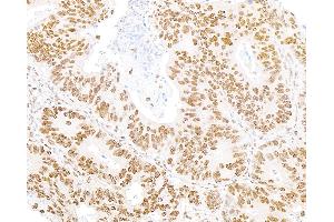 Immunohistochemistry (IHC) image for anti-5'-3' Exoribonuclease 2 (XRN2) (AA 900-950) antibody (ABIN7454718) (XRN2 Antikörper  (AA 900-950))