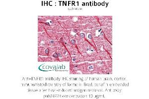 Image no. 1 for anti-Tumor Necrosis Factor Receptor Superfamily, Member 1A (TNFRSF1A) antibody (ABIN1740186) (TNFRSF1A Antikörper)