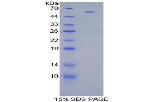 SDS-PAGE (SDS) image for Cartilage Intermediate Layer Protein, Nucleotide Pyrophosphohydrolase (CILP) (AA 604-864) protein (His tag,GST tag) (ABIN1877225) (CILP Protein (AA 604-864) (His tag,GST tag))