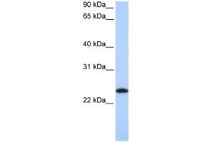 FTL antibody used at 1 ug/ml to detect target protein. (FTL Antikörper  (Middle Region))