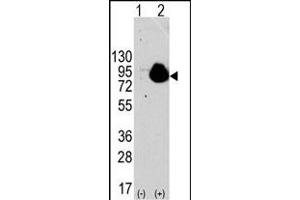 Western blot analysis of RPS6KA1 (arrow) using rabbit polyclonal RPS6KA1 Antibody . (RPS6KA1 Antikörper  (AA 710-735))