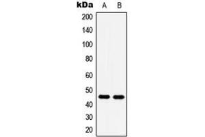 Western blot analysis of 5-HT1A expression in Saos2 (A), Jurkat (B) whole cell lysates. (Serotonin Receptor 1A Antikörper  (C-Term))