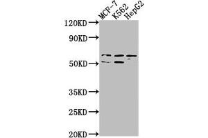 Western Blot Positive WB detected in: MCF-7 whole cell lysate, K562 whole cell lysate, HepG2 whole cell lysate All lanes: USP17L3 antibody at 1:1000 Secondary Goat polyclonal to rabbit IgG at 1/50000 dilution Predicted band size: 60 kDa Observed band size: 60 kDa (USP17L3 Antikörper  (C-Term))