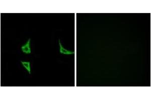 Immunofluorescence analysis of COS7 cells, using CaMK2 (Phospho-Thr286) Antibody. (CAMK2B Antikörper  (pThr286))