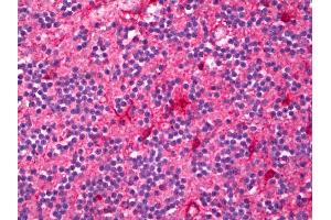 Anti-ENPP2 / Autotaxin antibody IHC of human brain, cerebellum. (ENPP2 Antikörper)