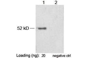 Lane 1: VSV-G-tag fusion protein in Hela cell lysate (~ 52 kD) Lane 2: Negative Hela cell lysateAntibody: 1 µg/mL Rabbit Anti-VSV-G-tag [HRP] Polyclonal Antibody (ABIN398532) The signal was developed with LumiSensorTM HRP Substrate Kit (ABIN769939) (VSV-g Tag Antikörper  (HRP))