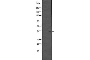 Western blot analysis of CPXCR1 expression in Fetal brain lysate (Human) ;,The lane on the left is treated with the antigen-specific peptide. (CPXCR1 Antikörper)