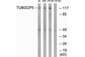 Western Blotting (WB) image for anti-Tubulin, gamma Complex Associated Protein 5 (TUBGCP5) (AA 741-790) antibody (ABIN2890336) (TUBGCP5 Antikörper  (AA 741-790))