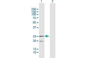 Western Blot analysis of MRPL12 expression in transfected 293T cell line by MRPL12 MaxPab polyclonal antibody. (MRPL12 Antikörper  (AA 1-198))