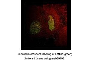 Image no. 1 for anti-LIM Domain Only 2 (Rhombotin-Like 1) (LMO2) antibody (ABIN363259) (LMO2 Antikörper)