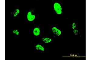 Immunofluorescence (IF) image for anti-Snail Family Zinc Finger 2 (SNAI2) (AA 97-169) antibody (ABIN520276)