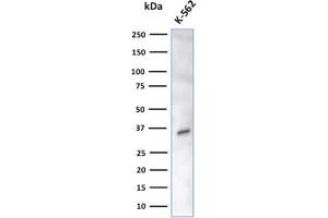 Western Blot Analysis of K-562 cell lysate using CA8 Mouse Monoclonal Antibody (CPTC-CA8-2). (CA8 Antikörper)