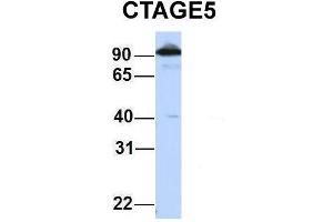 Host:  Rabbit  Target Name:  CTAGE5  Sample Type:  HepG2  Antibody Dilution:  1. (MIA2 Antikörper  (Middle Region))