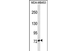 CUX1 Antibody (C-term) (ABIN1537517 and ABIN2850213) western blot analysis in MDA-M cell line lysates (35 μg/lane). (CUX1 Antikörper  (C-Term))