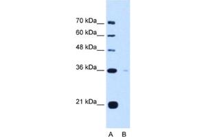 Western Blotting (WB) image for anti-Torsin Family 1, Member B (Torsin B) (TOR1B) antibody (ABIN2463038) (TOR1B Antikörper)