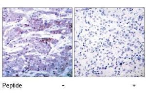 Image no. 1 for anti-BCL2-Associated Agonist of Cell Death (BAD) (Ser112) antibody (ABIN197208) (BAD Antikörper  (Ser112))
