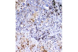 IHC analysis of Galectin 1 using anti-Galectin 1 antibody (ABIN3043804). (CD36 Antikörper  (N-Term))