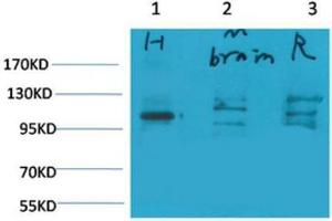 Western Blot (WB) analysis of 1) Human Brain Tissue, 2)Mouse Brain Tissue, 3) Rat Brain Tissue with Glutamate Receptor 1 Rabbit Polyclonal Antibody diluted at 1:2000. (Glutamate Receptor 1 Antikörper)