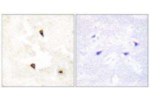 Immunohistochemistry (IHC) image for anti-Tumor Protein P53 Inducible Protein 11 (TP53I11) (Internal Region) antibody (ABIN1848934) (TP53I11 Antikörper  (Internal Region))