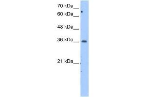 MDH1 antibody used at 2. (MDH1 Antikörper)