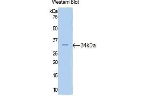 Western blot analysis of the recombinant protein. (Fascin 2 Antikörper  (AA 8-278))