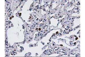Immunohistochemical staining of paraffin-embedded Human lung tissue using anti-CCM2 mouse monoclonal antibody. (CCM2 Antikörper)