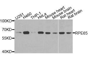 Western blot analysis of extracts of various cell lines, using RPE65 antibody (ABIN6003573) at 1/1000 dilution. (RPE65 Antikörper)