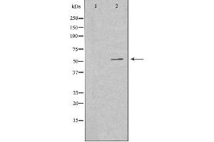 Western blot analysis of extracts from A549 cells using G3BP2 antibody. (G3BP2 Antikörper  (C-Term))