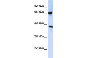 WB Suggested Anti-C6orf134 Antibody Titration:  0. (Chromosome 6 Open Reading Frame 134 (C6orf134) (Middle Region) Antikörper)