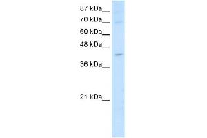 WB Suggested Anti-NXF5 Antibody Titration:  2. (NXF5 Antikörper  (Middle Region))