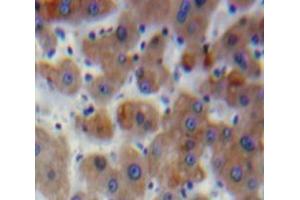 Used in DAB staining on fromalin fixed paraffin-embedded Liver tissue (SERPINB2 Antikörper  (AA 68-313))