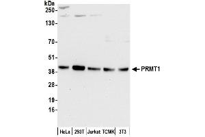 Western Blotting (WB) image for anti-Protein Arginine Methyltransferase 1 (PRMT1) (AA 1-50) antibody (ABIN7453933) (PRMT1 Antikörper  (AA 1-50))