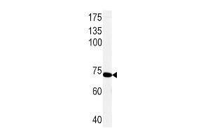 Western blot analysis of PCK1 Antibody (C-term) (ABIN1882180 and ABIN2842170) in rat primary hepatocyte cell line lysates. (PCK1 Antikörper  (C-Term))