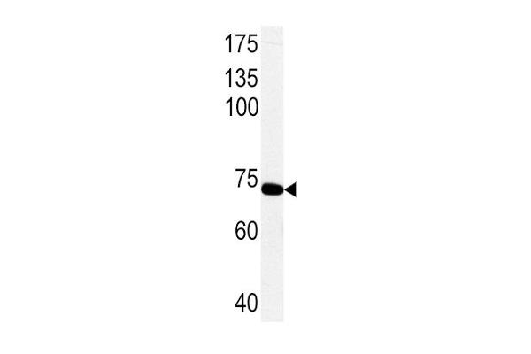 PCK1 Antikörper  (C-Term)