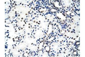Nucleolin antibody was used for immunohistochemistry at a concentration of 4-8 ug/ml to stain Epithelial cells of renal tubule (arrows) in Human Kidney. (Nucleolin Antikörper  (C-Term))