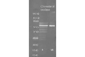 Goat anti Cholesterol oxidase antibody  was used to detect purified cholesterol oxidase under reducing (R) and non-reducing (NR) conditions. (Cholesterol Oxidase Antikörper  (HRP))